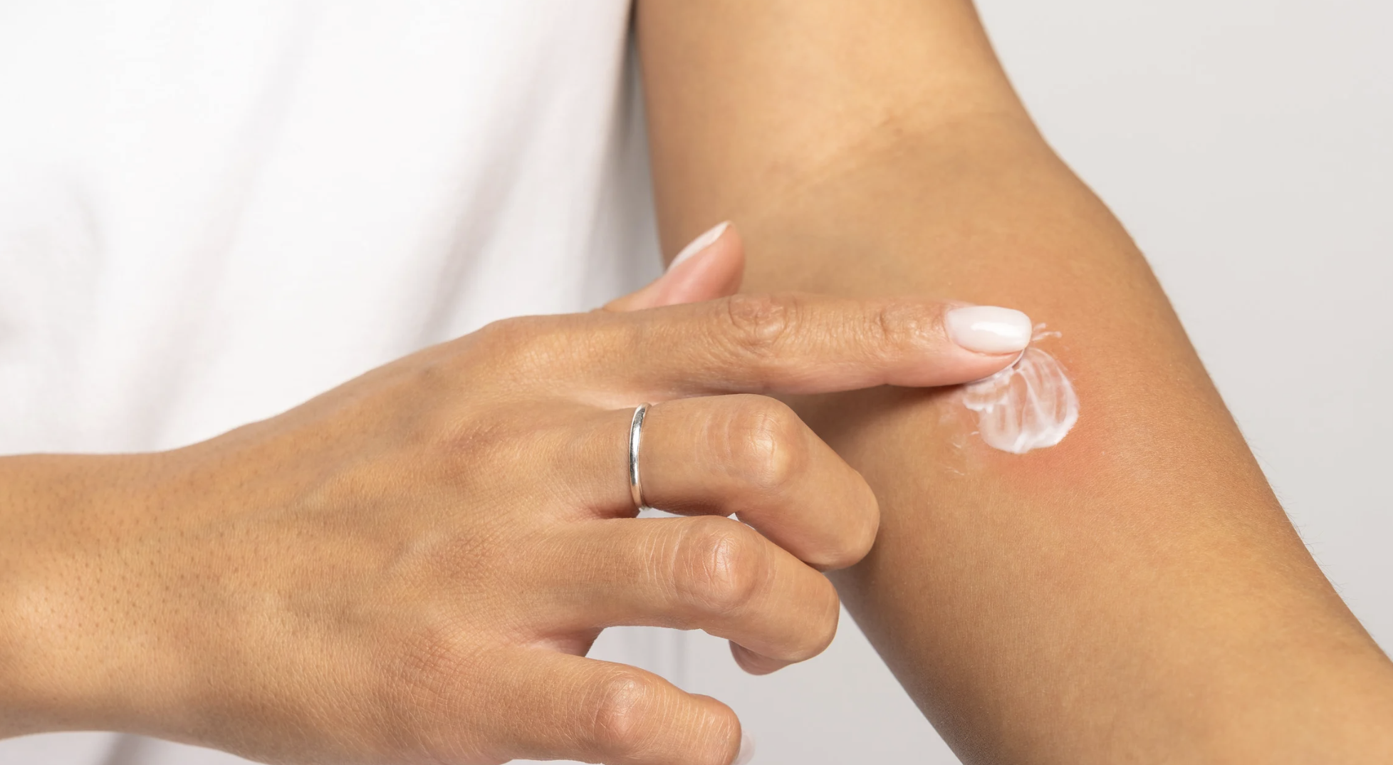 벌레물림약 주요 성분과 작용 원리