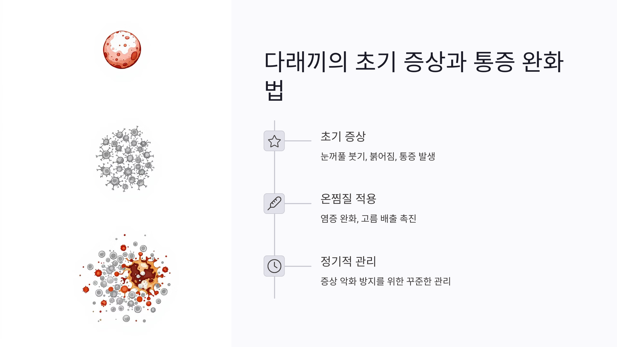 다래끼 발생 시 적절한 대처 방법