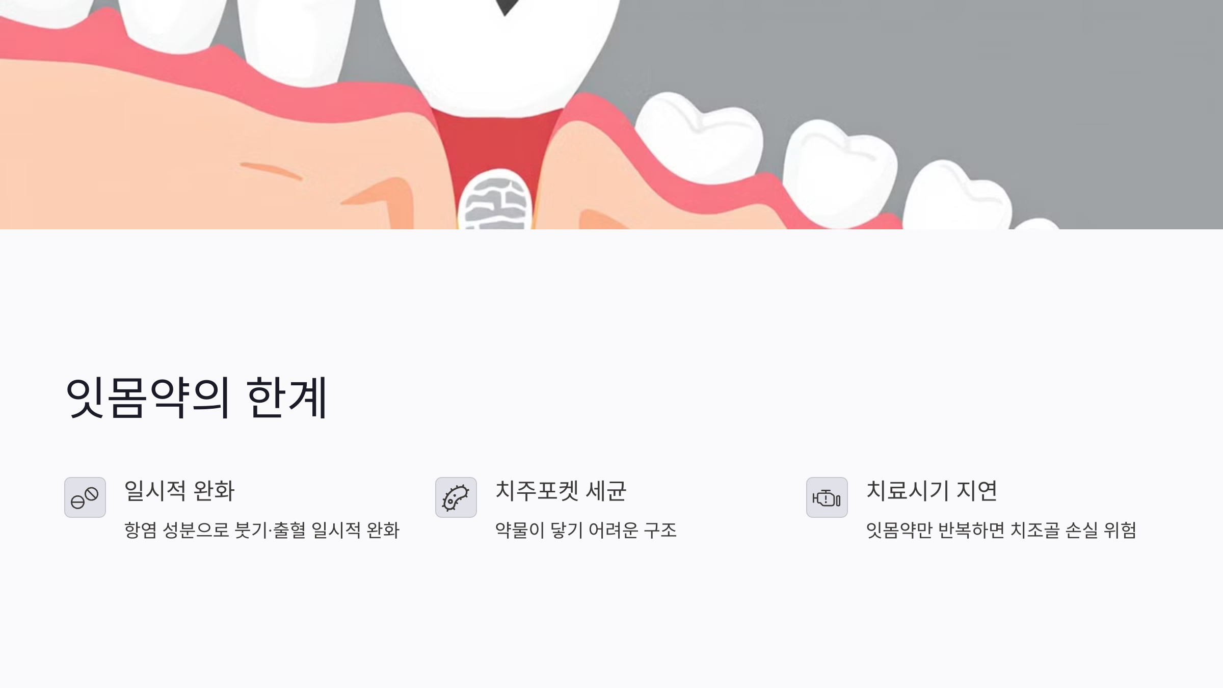 잇몸약 효과 범위는 어디까지일까?