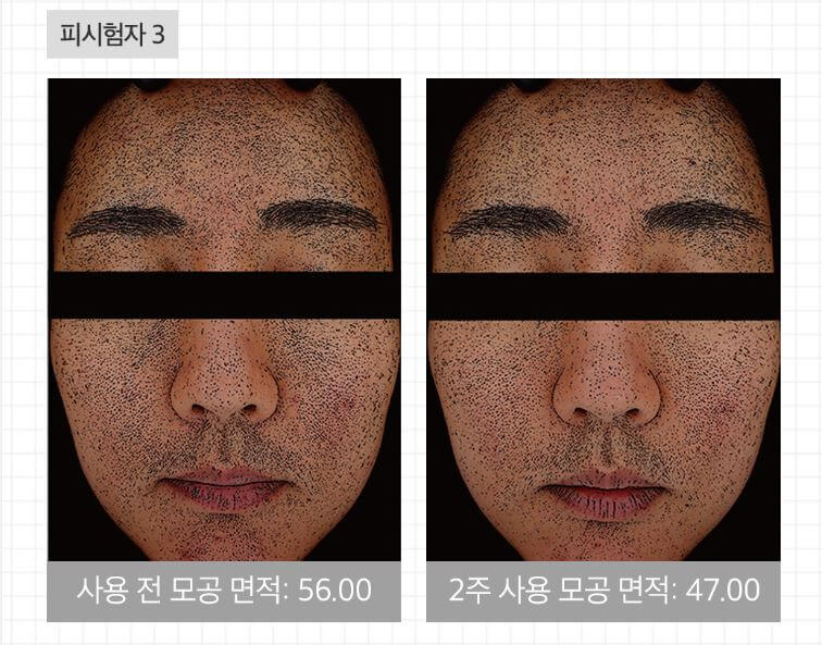 메디큐브 제로모공패드 2.0 효과 및 가격 (유재석 패드)