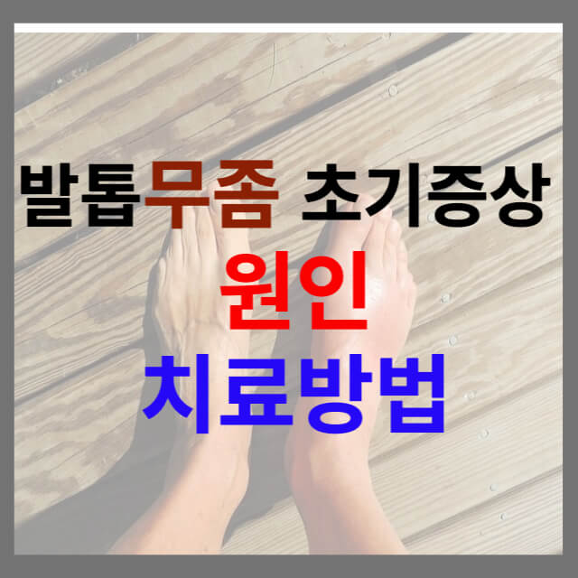 발톱무좀증상