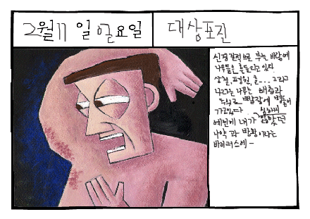 대상포진