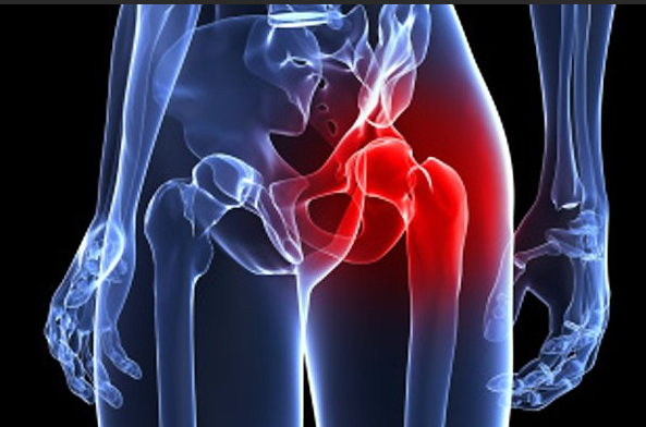 고관절 통증 위치