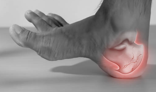 발바닥통증의 원인 24