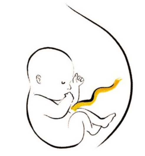 모성간호-두정위