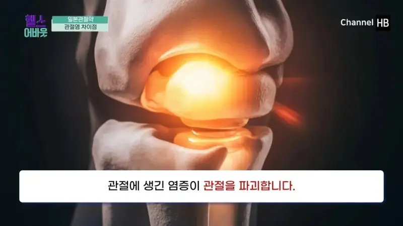 일본무릎관절염약