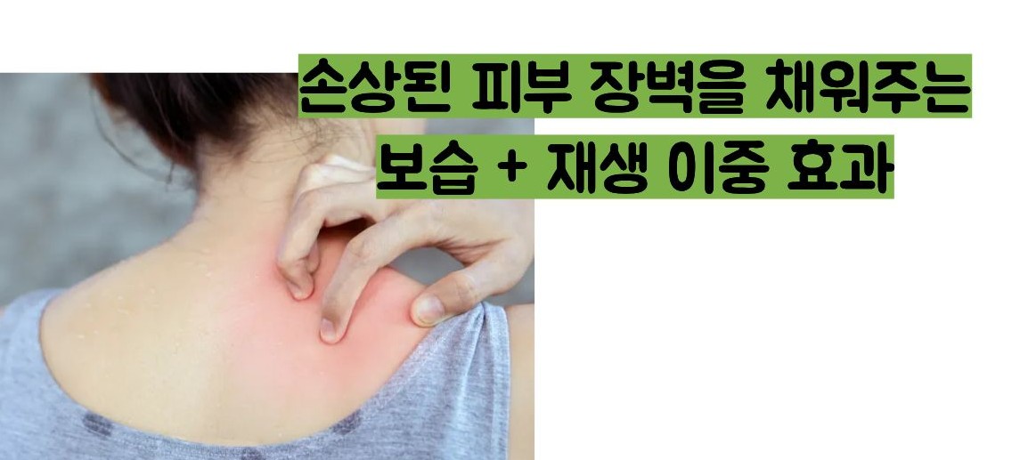 비판텐 연고 효능