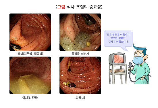 대장내시경, 장정결제