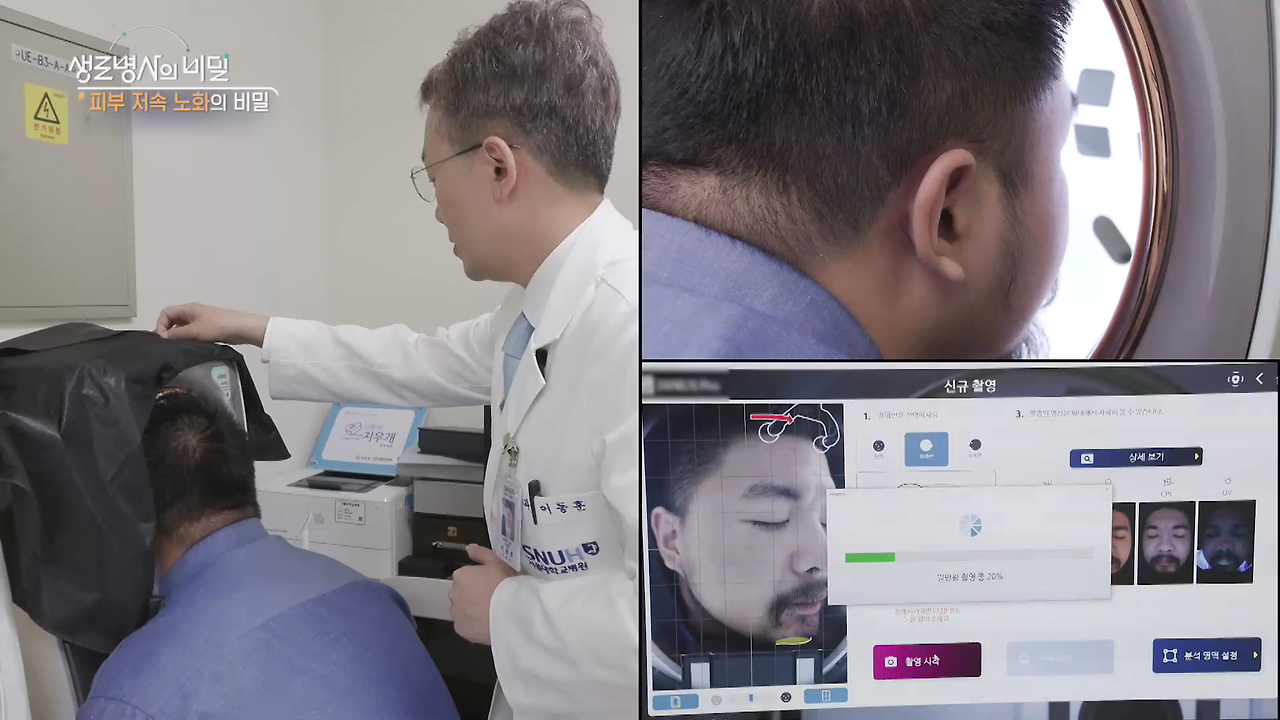 생로병사의 비밀 피부 저속노화의 비밀