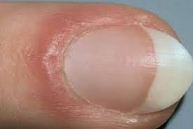 손톱 색깔로 보는 건강