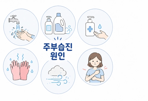 주부습진 증상