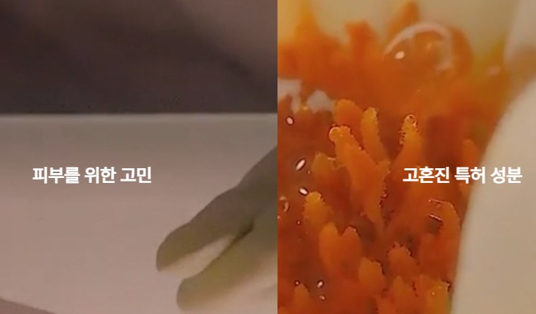 고호진 검버섯 크림