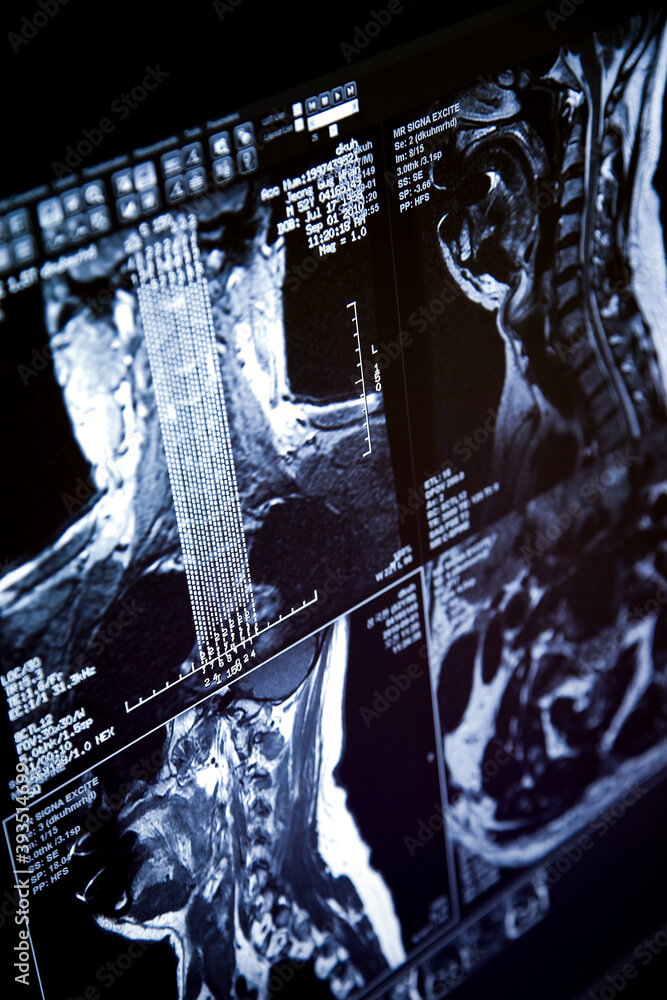 40대 남자 가장을 위한 필수 보험 종류: 가족의 미래를 지키는 방법
