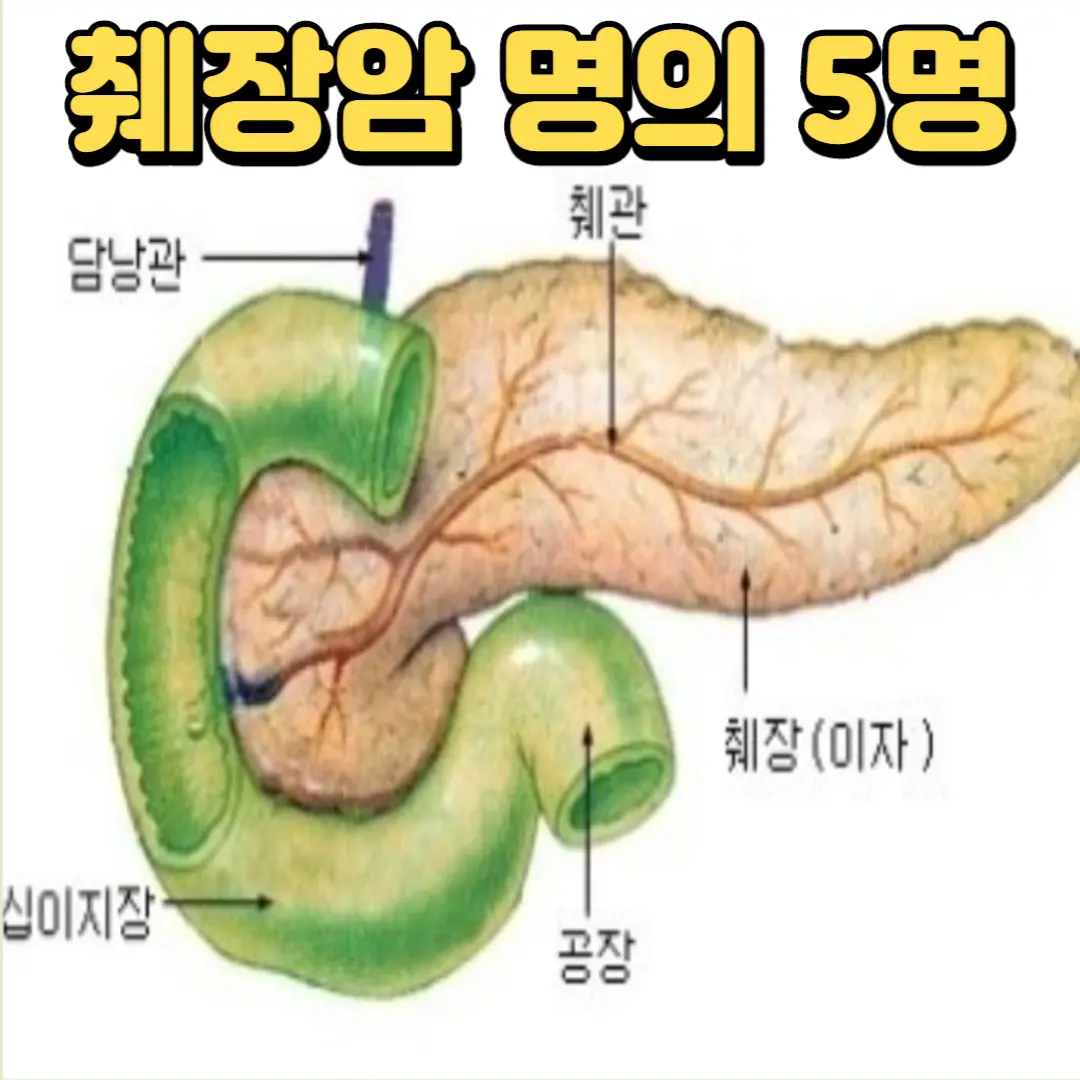 췌장암 명의5명