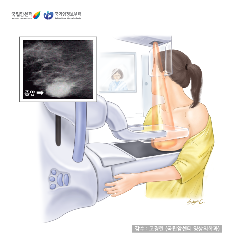 유방촬영술