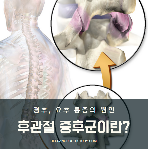 후관절