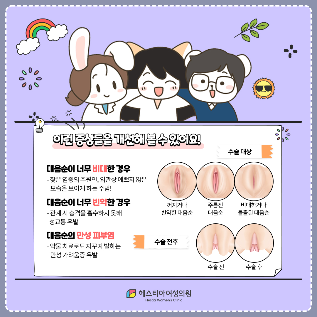 여자 사타구니가려움, 음부 가려움 원인 
대음순수술