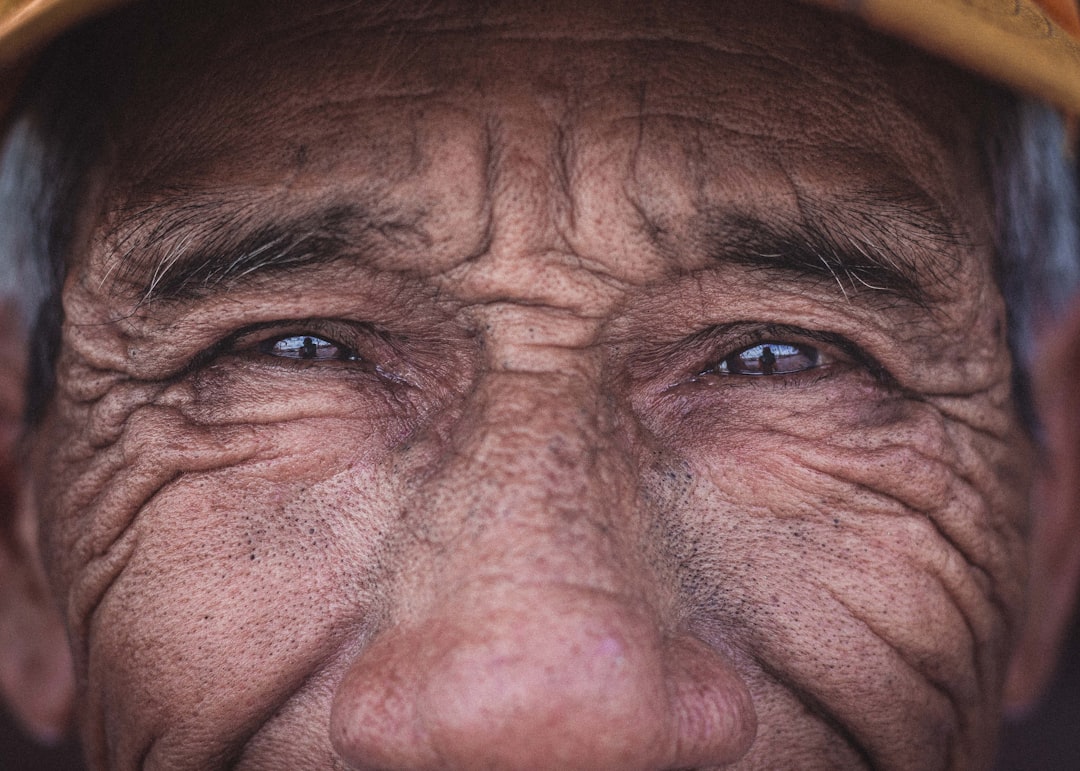 Anti-aging