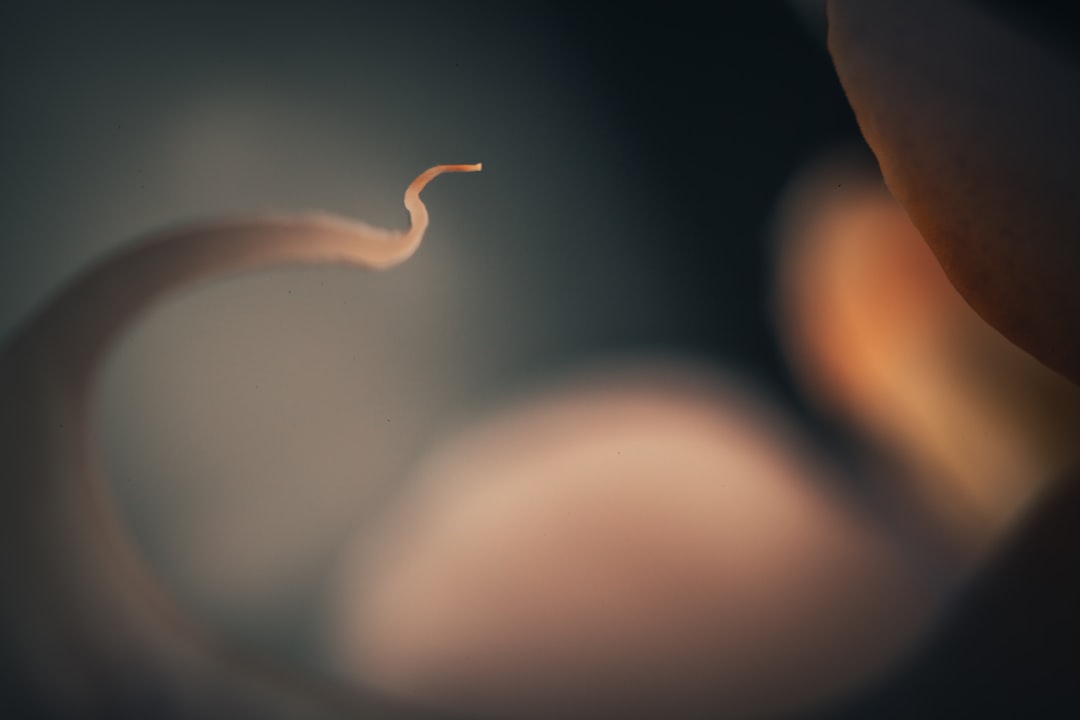 Fetus