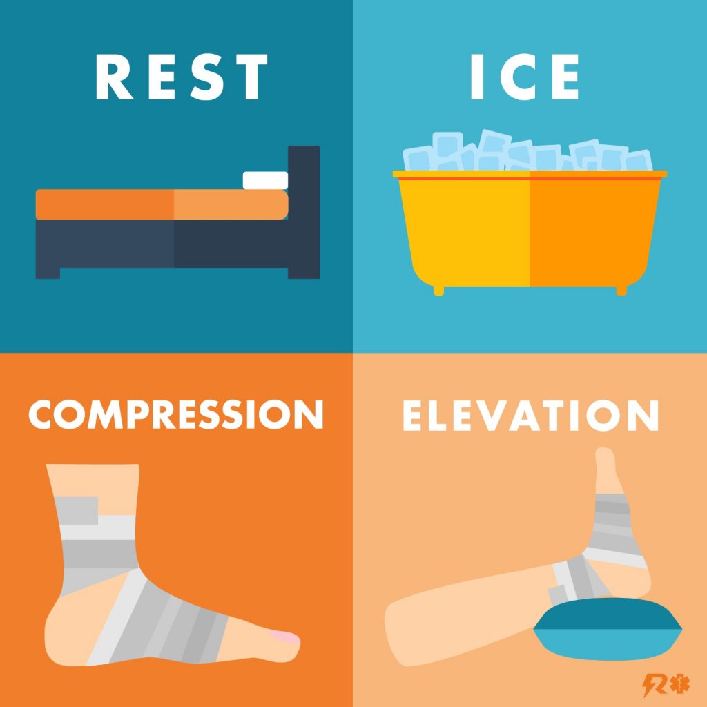 anklesprain-RICEtreatment
