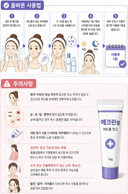 여드름 연고 사용법 인포그래픽으로 세안 후 에크린겔 바르는 순서, 스킨케어 단계, 사용 주기와 함께 눈·입 접촉 주의, 임산부 사용 제한 등 주의사항을 정리한 이미지