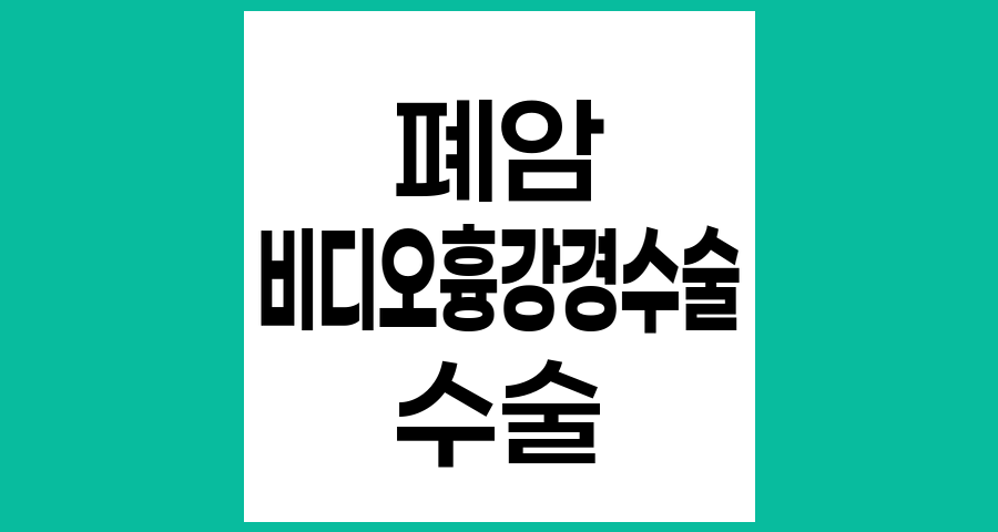 폐암에서 비디오흉강경 수술(VATS) 적용 기준과 한계