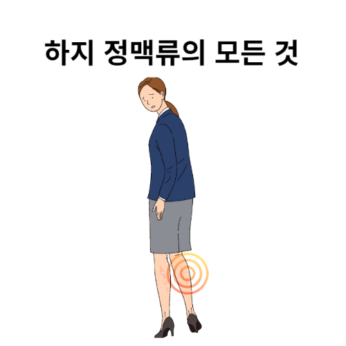 하지 정맥류 원인-증상-자가 진단