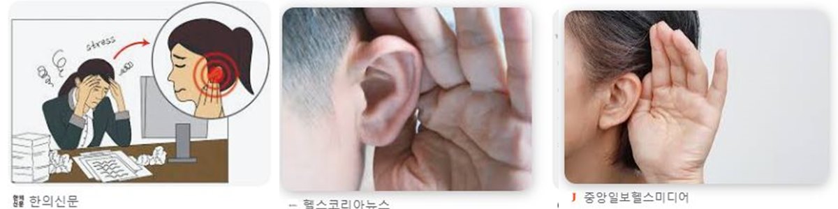 돌발성난청-썸네일