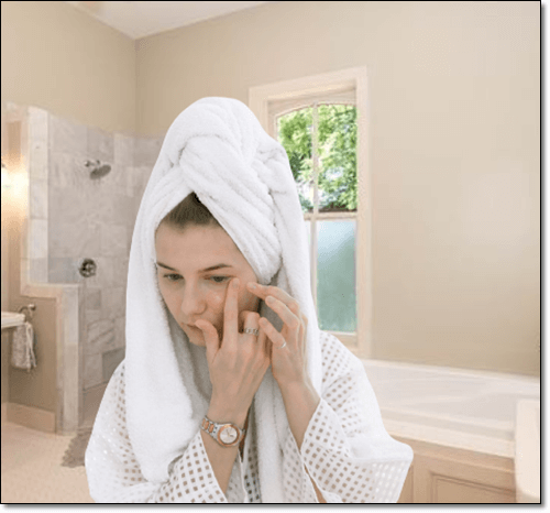 피지낭종이 생긴 여성