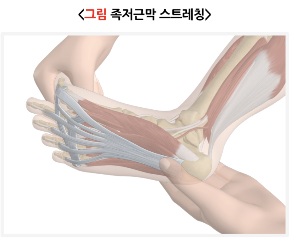 족저근막 스트레칭