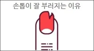 손톱이 잘 부러지는 이유