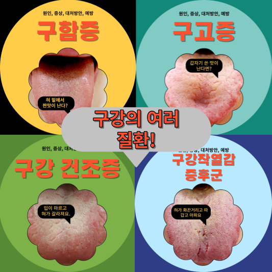 구함증, 구고증, 구강건조증, 구강작열감증후군: 이들의 원인과 증상을 파헤쳐보자