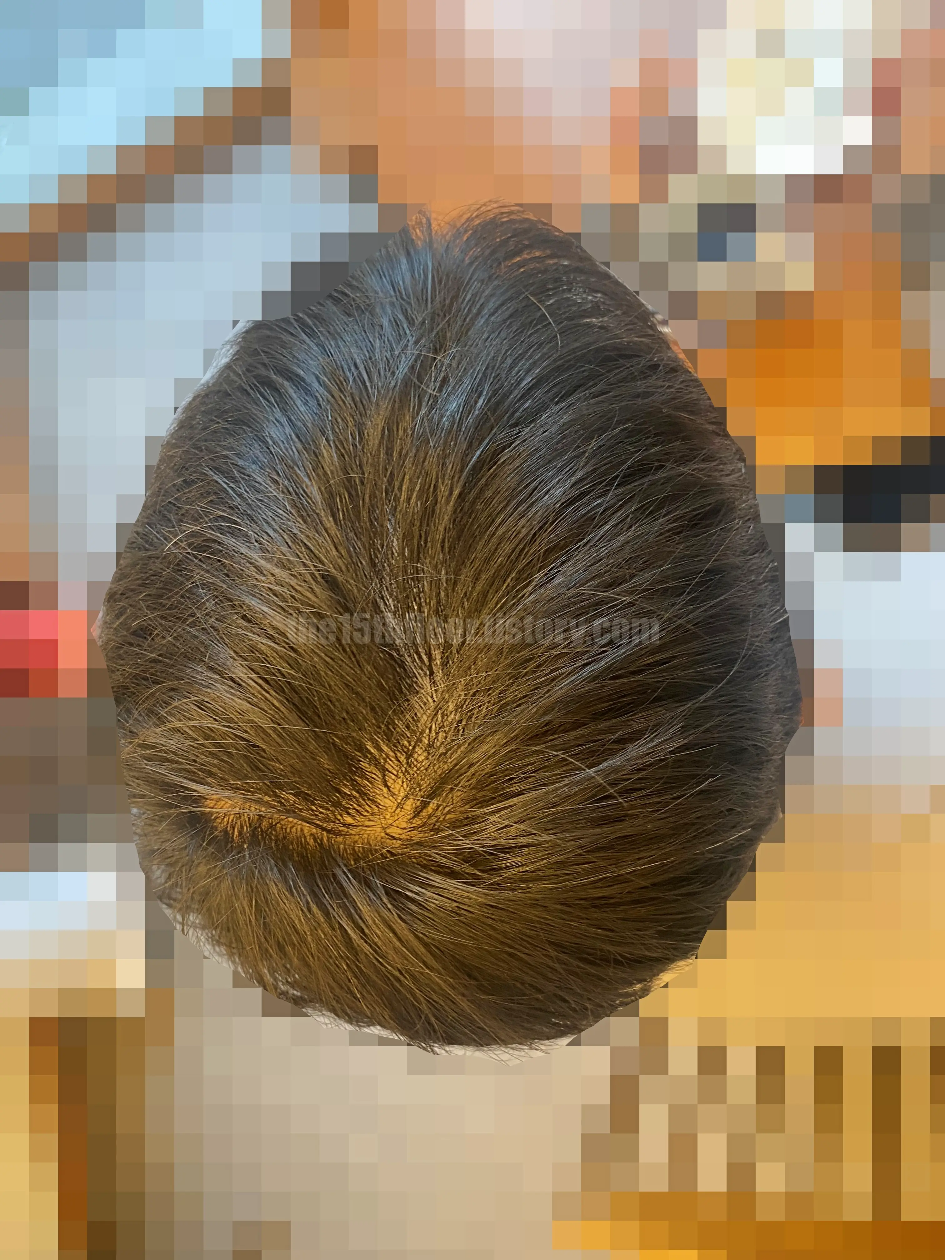 로게인폼 3개월 사용 후기 (사용 후)