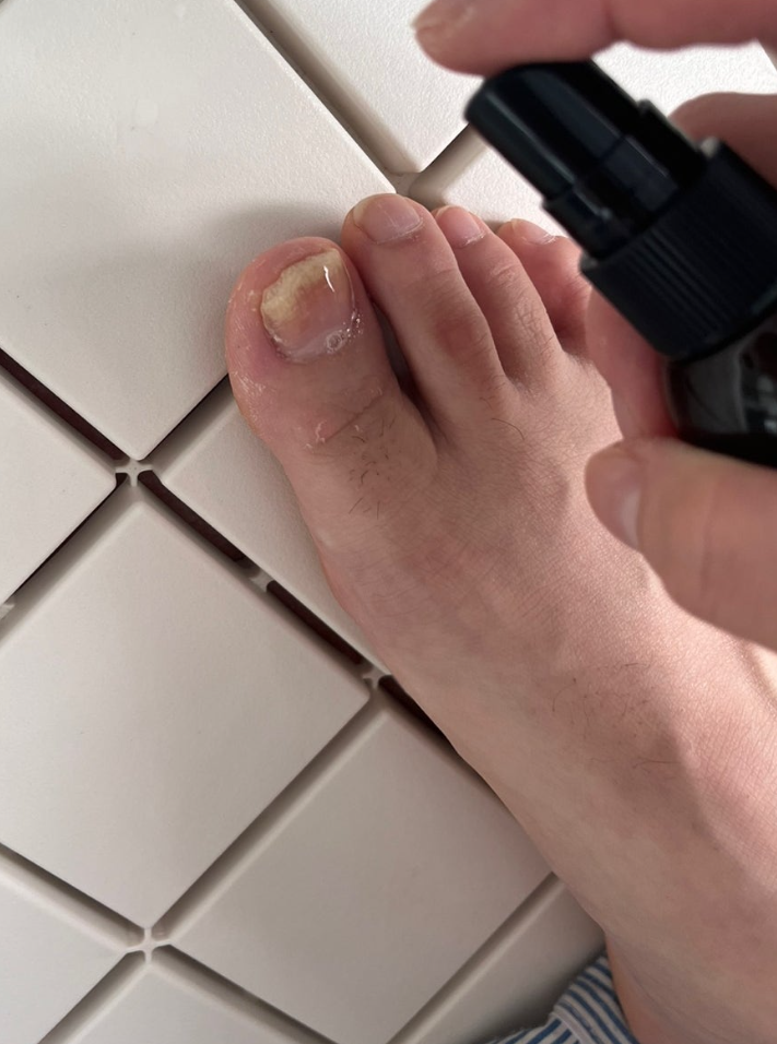 타무신큐 유산균 미스트 내돈내산