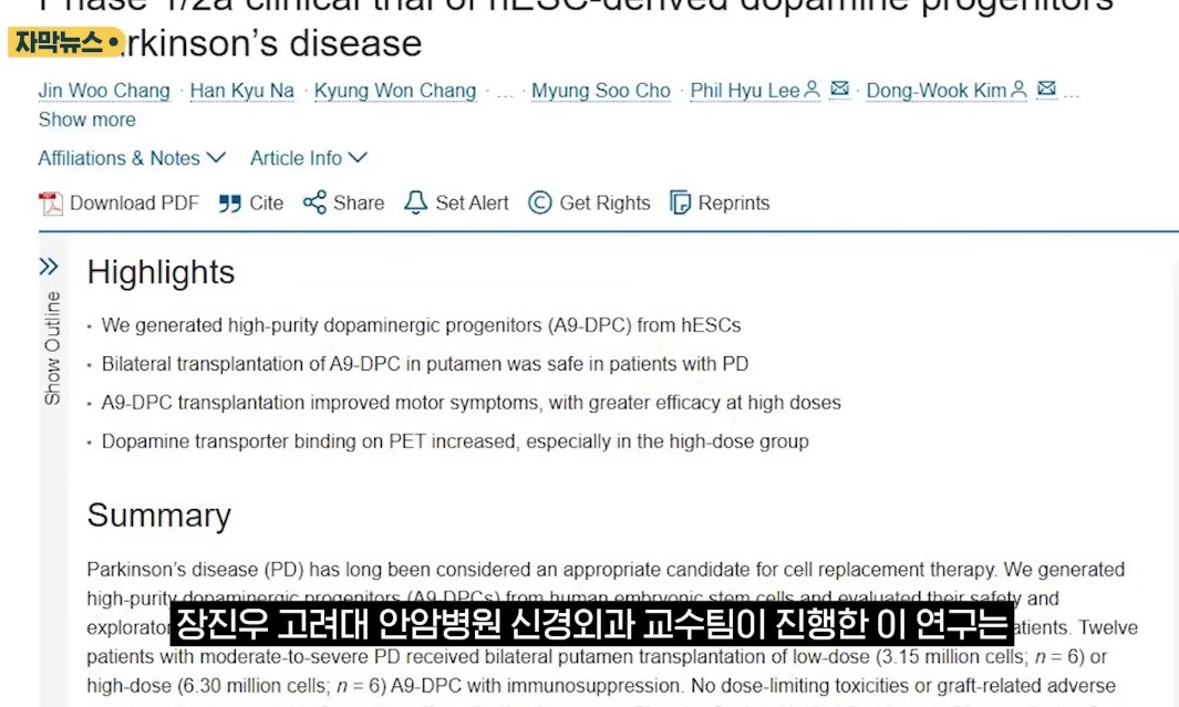 신경외과-장진우-교수