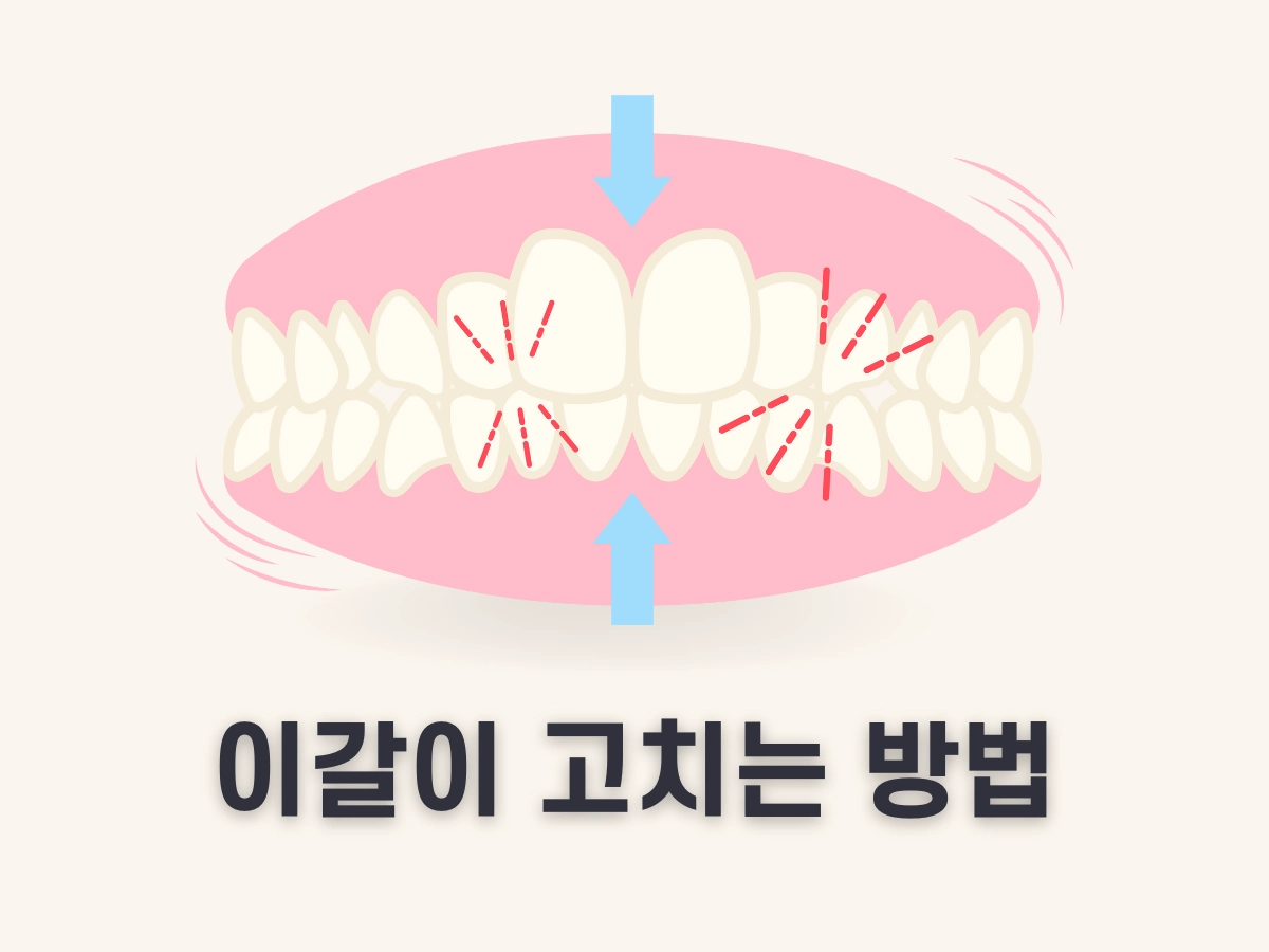 이갈이