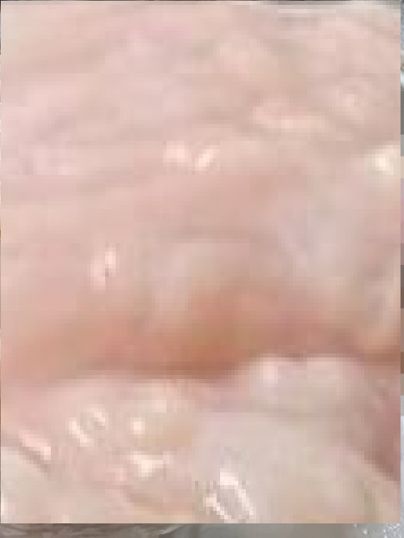 하림통닭(모자이크)_썸네일