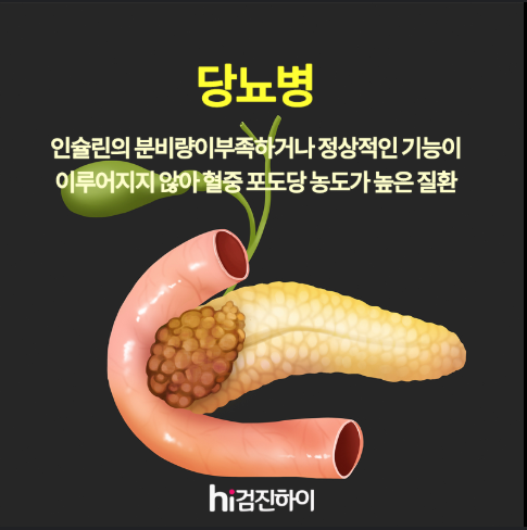 당뇨병