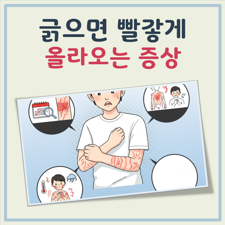 긁으면 빨갛게 올라오는 증상 대표 이미지