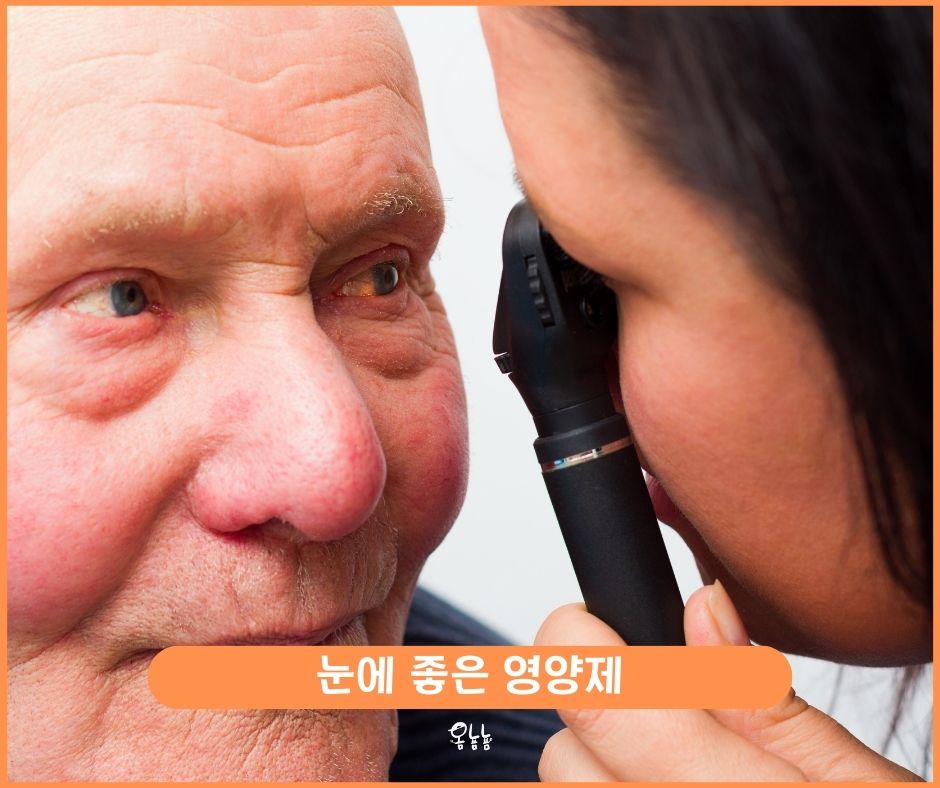 눈에 좋은 영양제