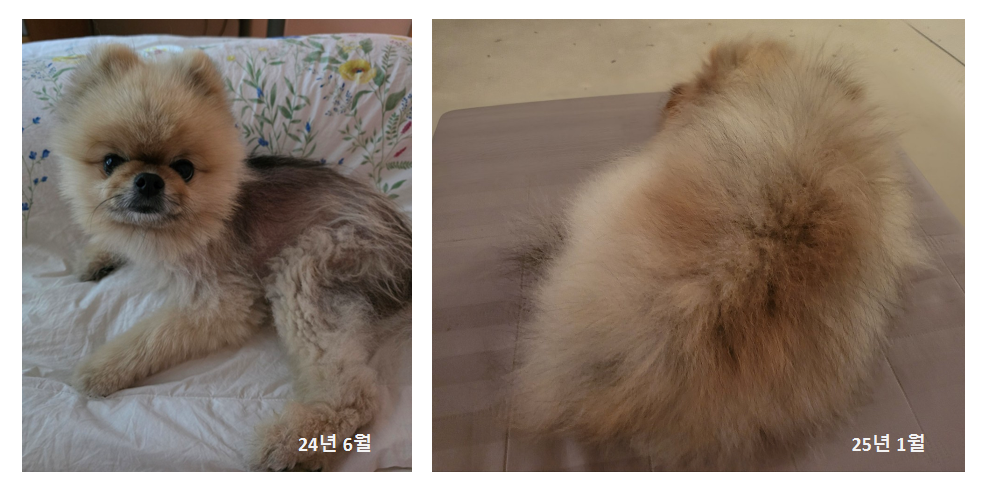 6개월 사이 탈모 극복 사진