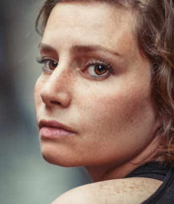 피부질환 종류 연고 종류 이유