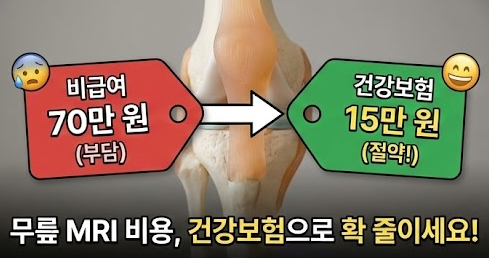 무릎 MRI/초음파 건강보험 적용 기준