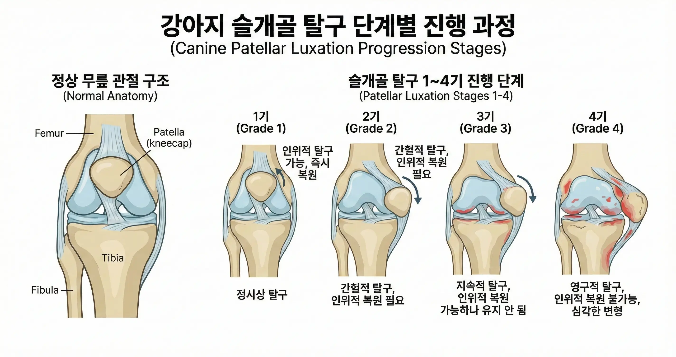 강아지 무릎 관절 구조와 슬개골 탈구 1~4기 진행 단계 일러스트