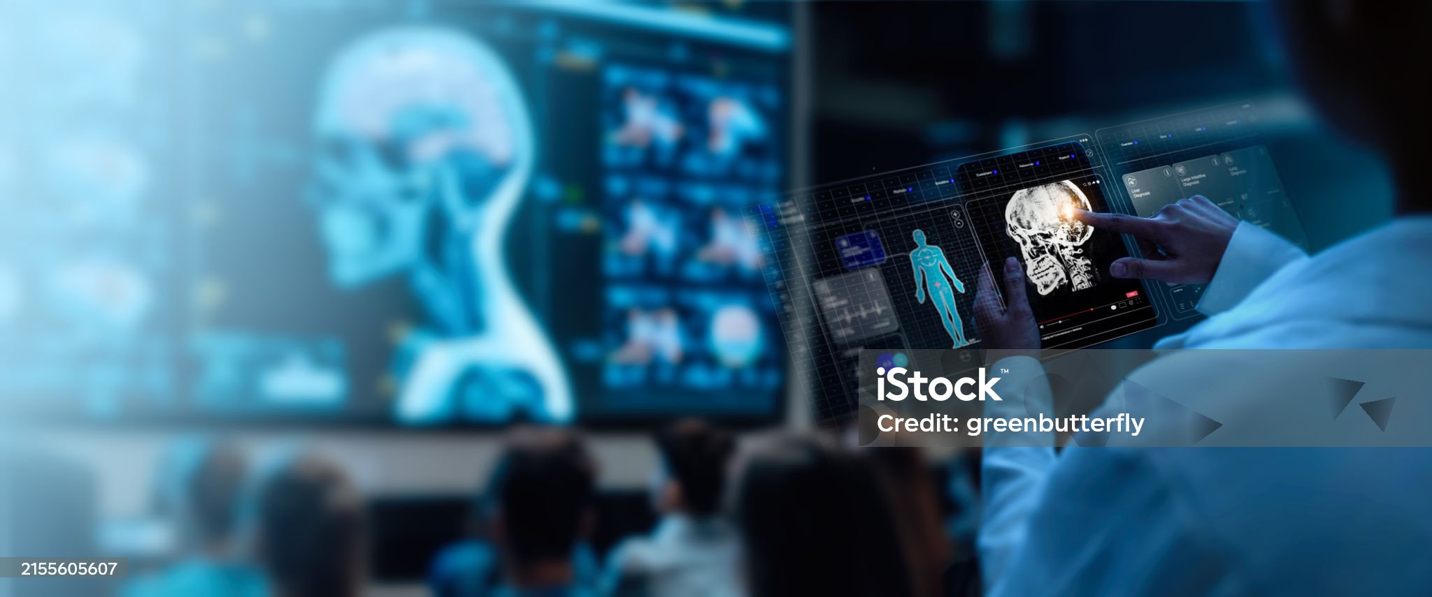 인공지능(AI)이 영상의학에 도움을 줄 수 있을까?