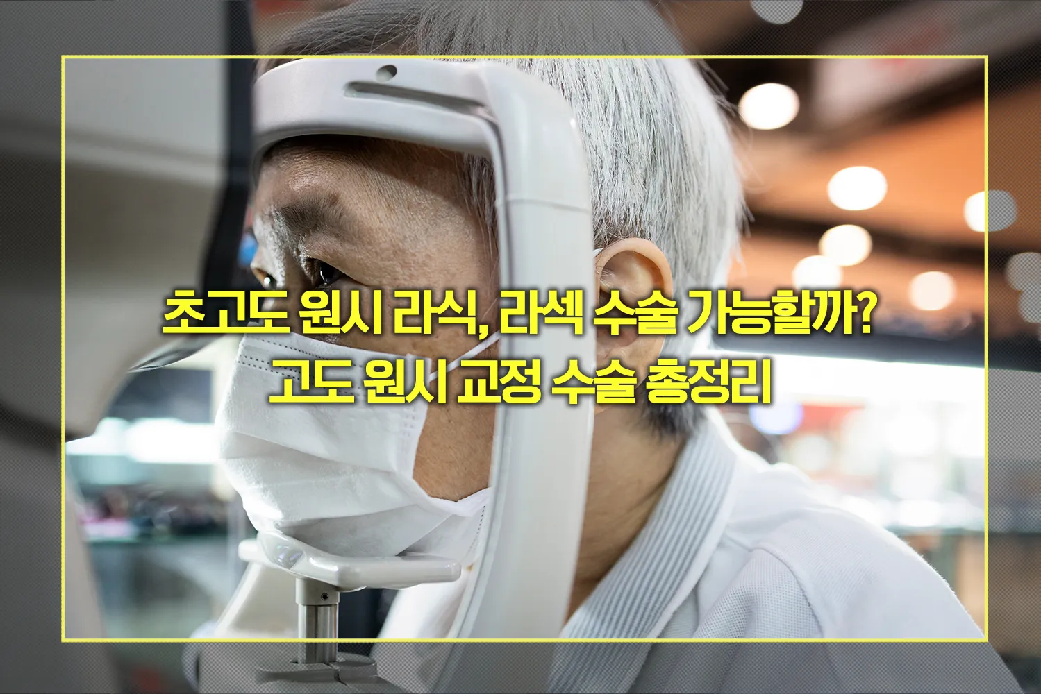 초고도원시-라식라섹-수술정리