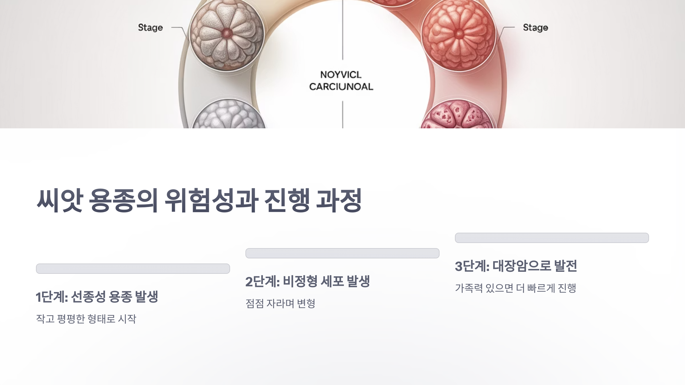 참조-대장암-씨앗-용종-진단-3