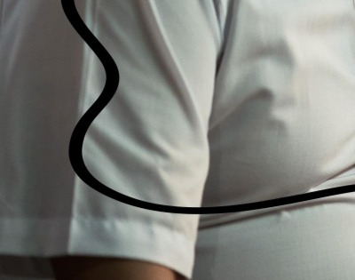 알콜성 치매 초기증상