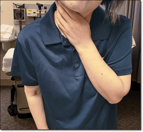 목 몽우리가 생긴 여성