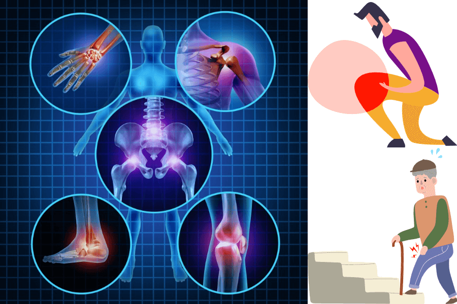 골다공증, 뼈관절